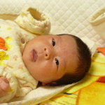 赤ちゃん生後１か月　乳児湿疹画像